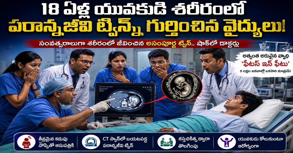 18 ఏళ్ల యువకుడి శరీరంలో సంవత్సరాలుగా జీవించిన ‘పరాన్నజీవి ట్విన్’ను గుర్తించిన వైద్యులు